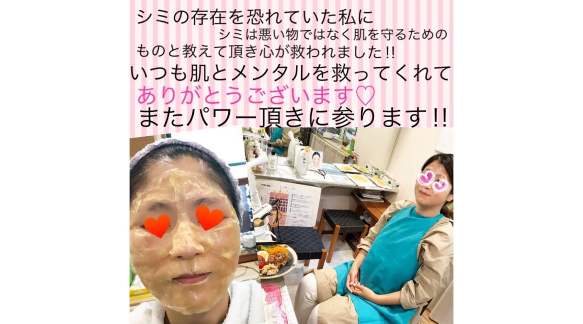 松ヤニ、シミシワ
